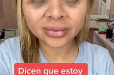 Woman leaves internet stunned with ‘incredible’ transformation