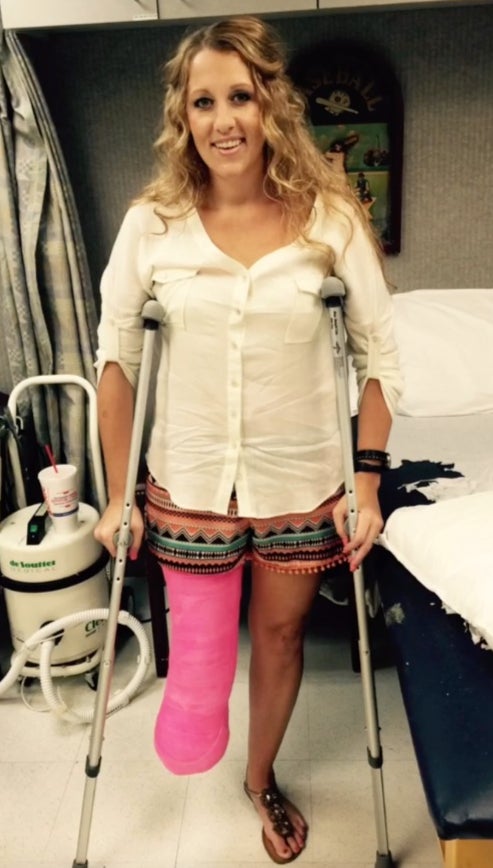 Angie Fowler had her leg amputated after contracting a bacterial infection