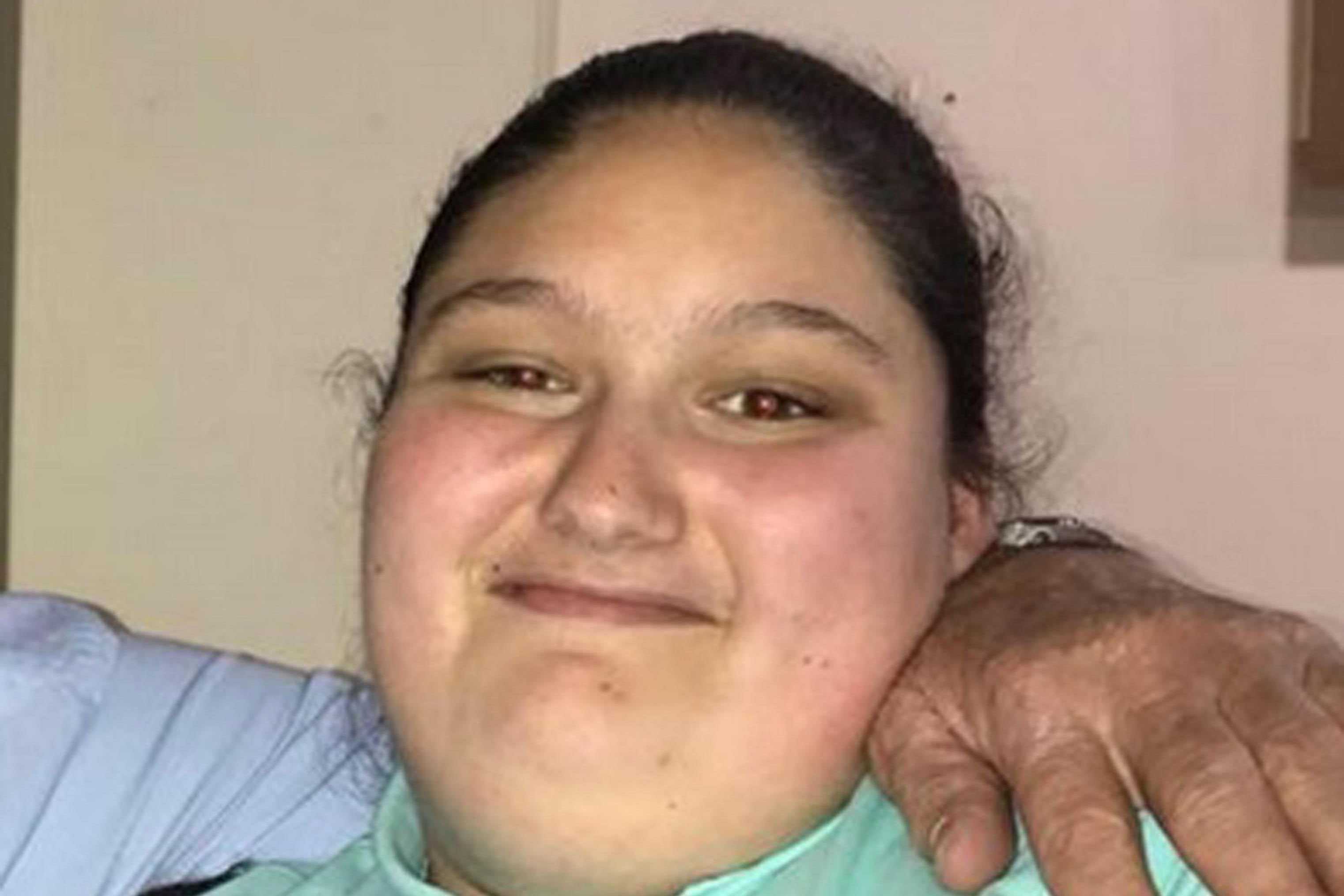 Kaylea Titford died after suffering inflammation and infection from ulceration, arising from obesity and immobility