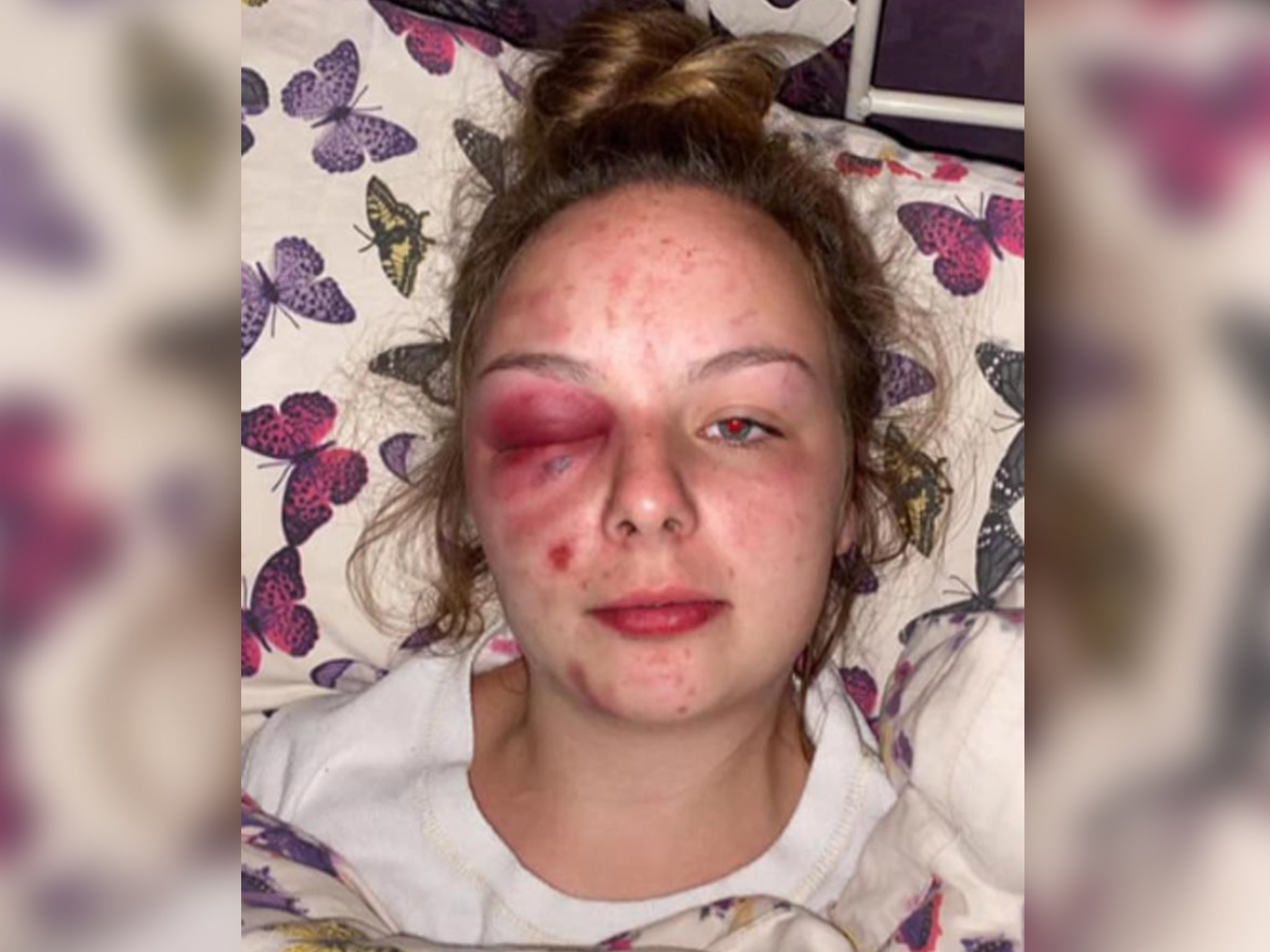 Williams posted a picture of her injuries online - but they were self inflicted