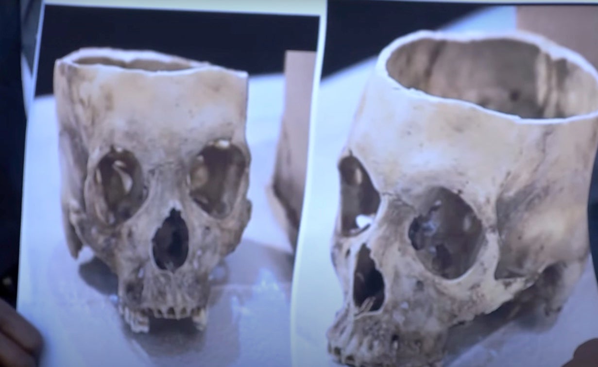 Images of Rasheem Carter’s skull are shown at a press conference