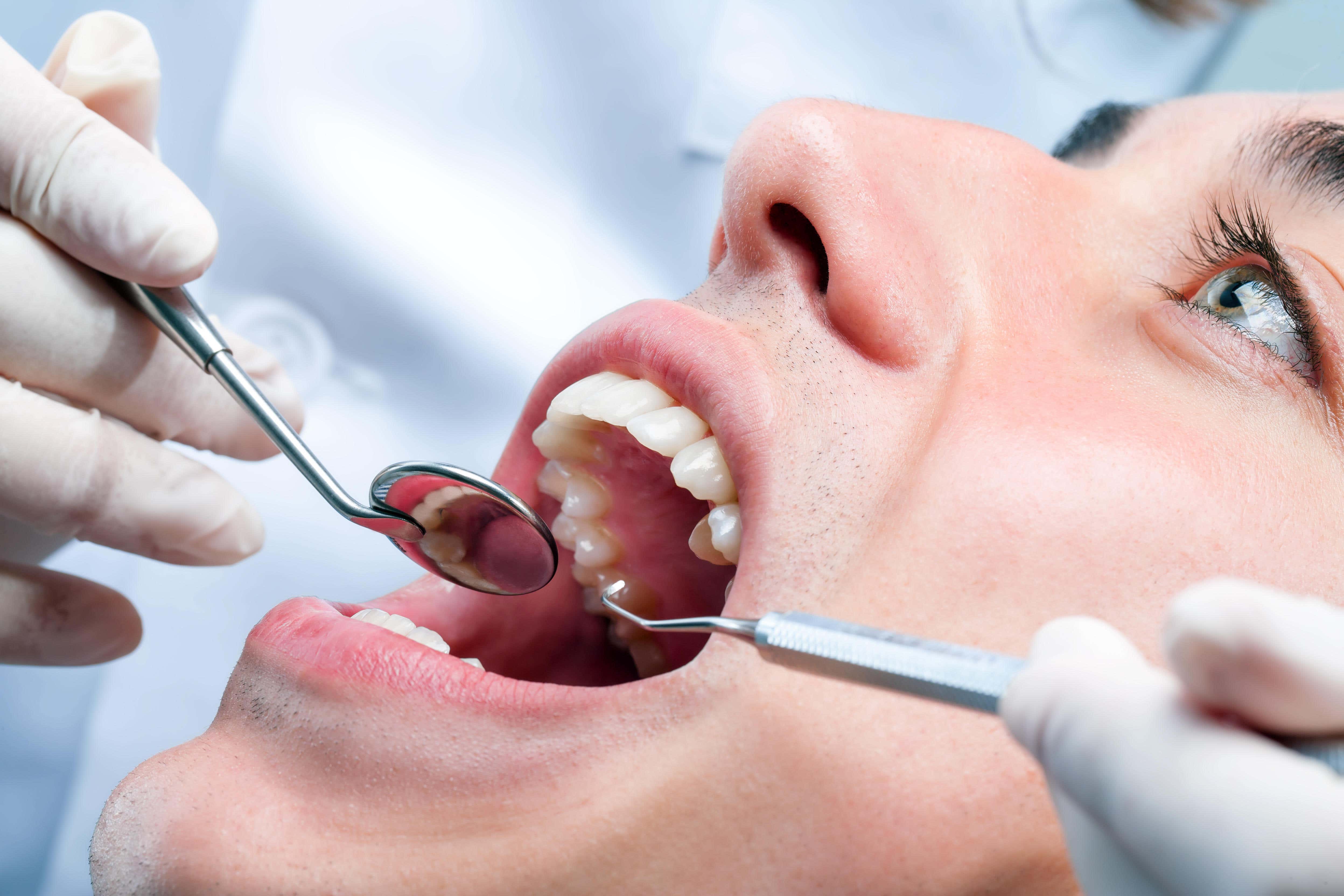 Bad breath and strange gums may be a sign of more than just too much garlic and not enough brushing (Alamy/PA)