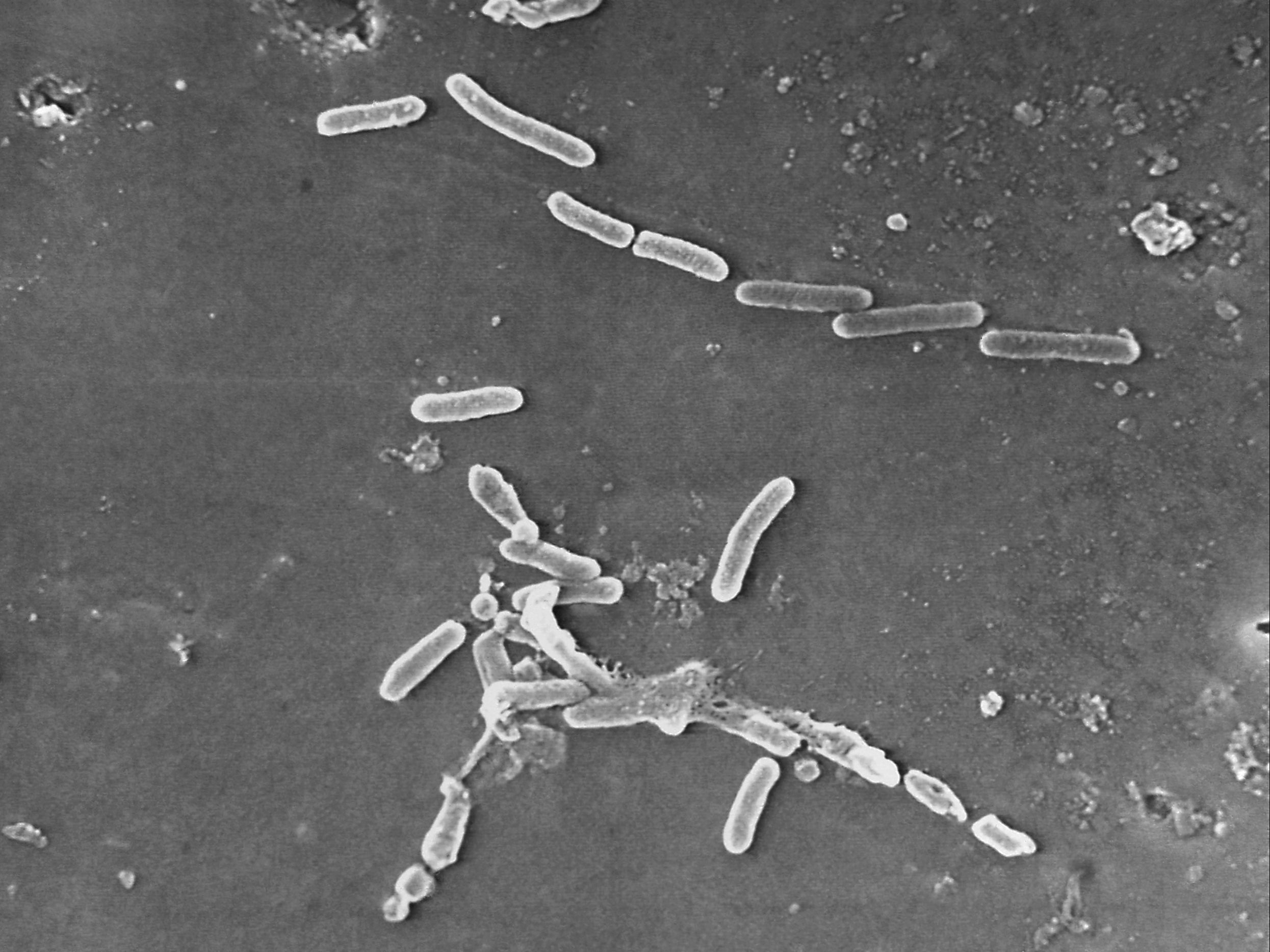 This scanning electron microscope image made available by the Centers for Disease Control and Prevention shows rod-shaped Pseudomonas aeruginosa bacteria. U.S. officials are reporting two more deaths and additional cases of vision loss linked to eyedrops tainted with the drug-resistant bacteria. The eyedrops from EzriCare and Delsam Phama were recalled in February 2023 and health authorities are continuing to track infections as they investigate the outbreak. (Janice Haney Carr/Centers for Disease Control and Prevention via AP, File)