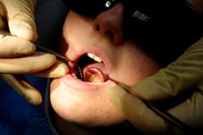 One in 10 people have performed DIY dentistry, poll finds