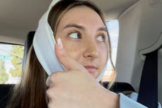 Woman bullied for looking like squirrel has stomach fat put into jaw