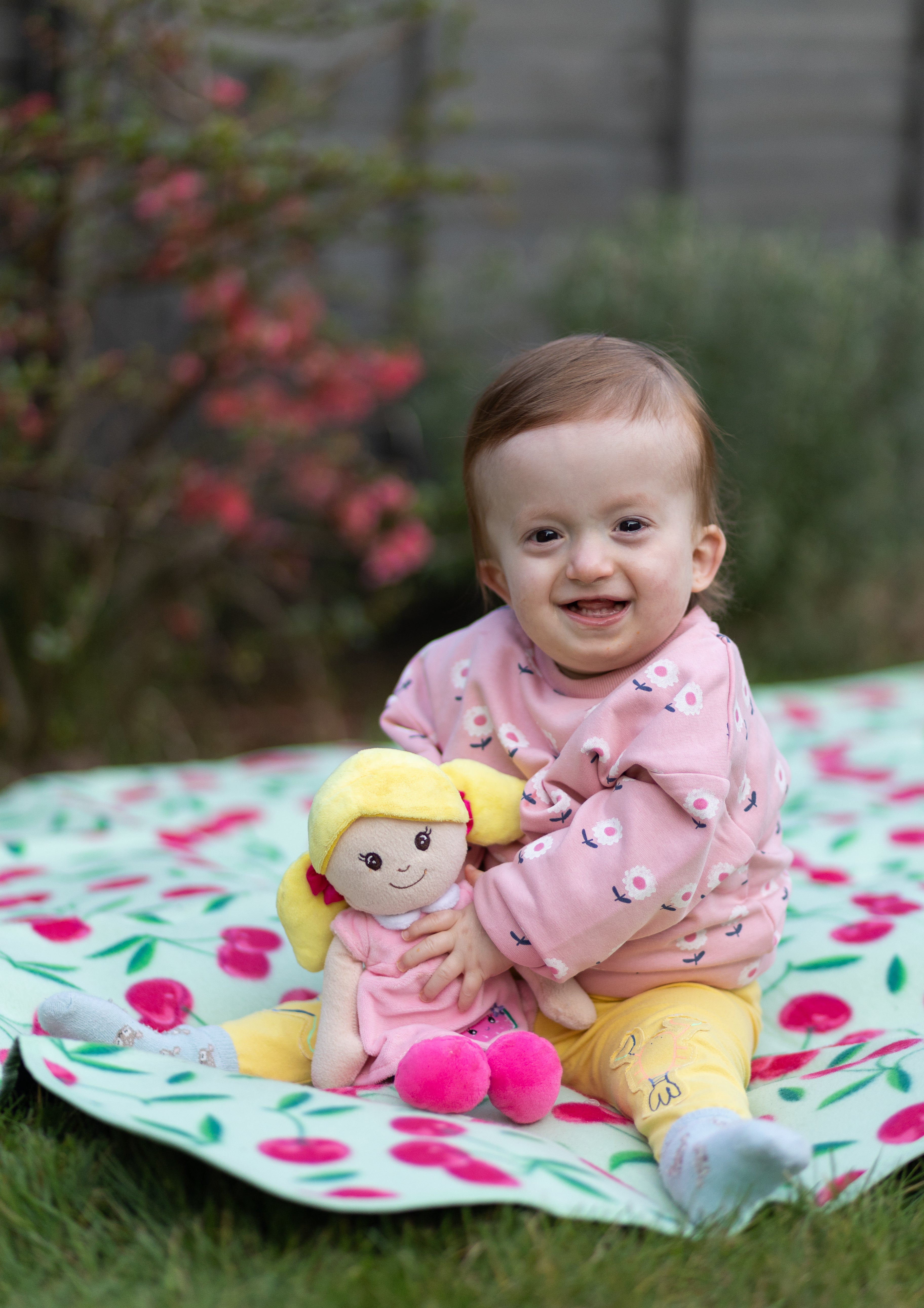 Sofia Brogden was diagnosed with Turnpenny-Fry syndrome, a rare genetic condition that causes learning difficulties, impaired growth, and distinctive facial features that include a large forehead and sparse hair