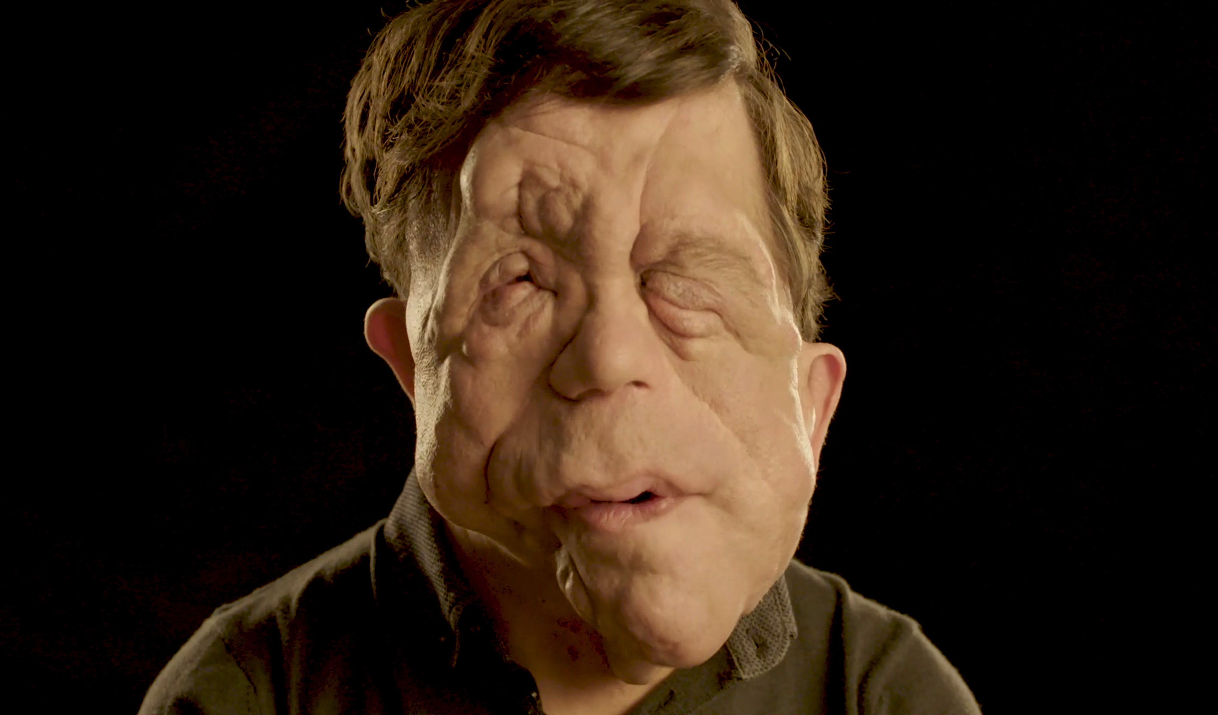 Actor and presenter Adam Pearson, who is a Changing Faces ambassador, has urged police forces to “do more” as the number of people with visible differences or disfigurements who say they were the victim of a hate crime has increased since 2019