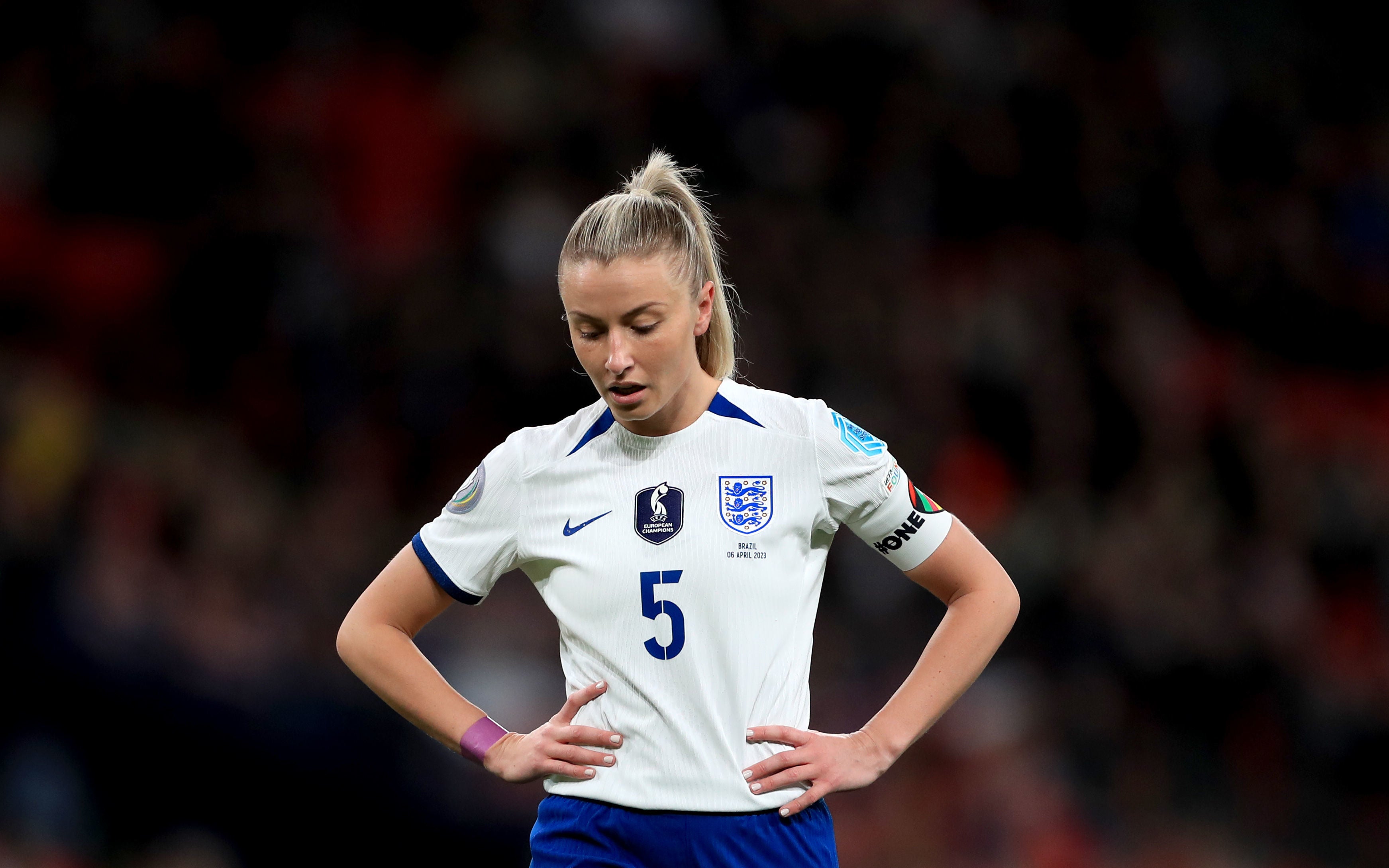 England’s Leah Williamson suffered a ruptured anterior cruciate ligament injury