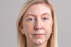 Mother claims using a miraculous eye cream has taken years off her in just weeks