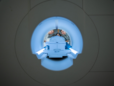 Brain scans linked to ChatGPT-like AI model found capable of revealing people’s thoughts