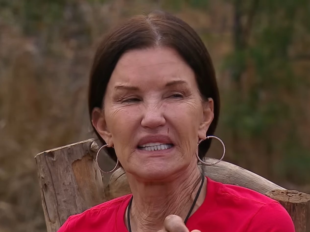 Janice Dickinson on ‘I’m a Celebrity... South Africa'