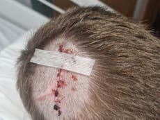 Mother of boy who suffered head injuries after dog bite in pub garden demands owners come forward