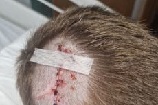 Mother of boy who suffered head injuries after dog bite in pub garden demands owners come forward