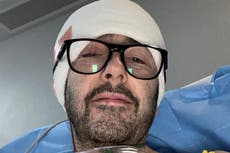 Father shares cancer symptoms he thought was too much coffee