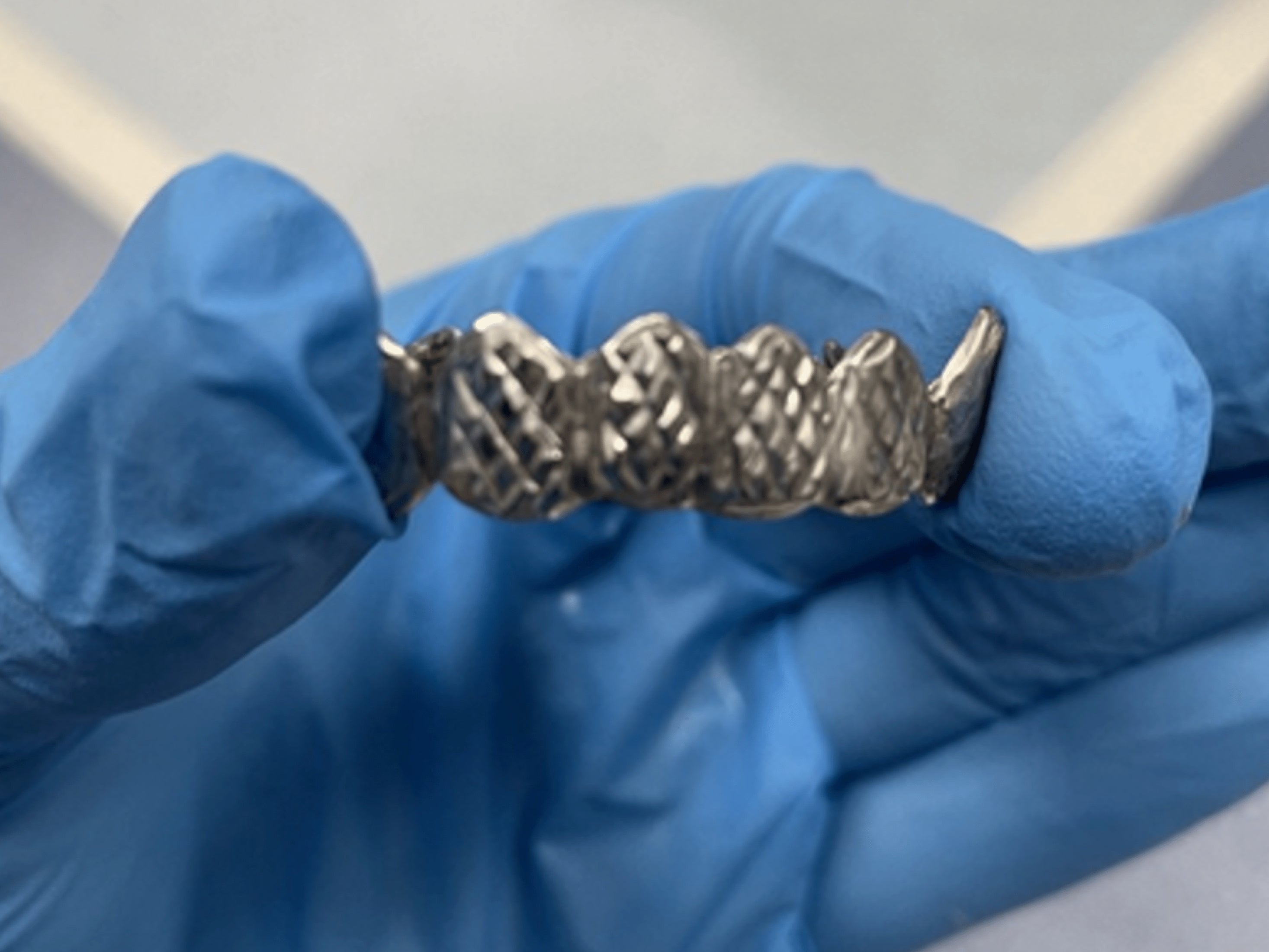 A doctor holds a row of false teeth removed from man’s airway