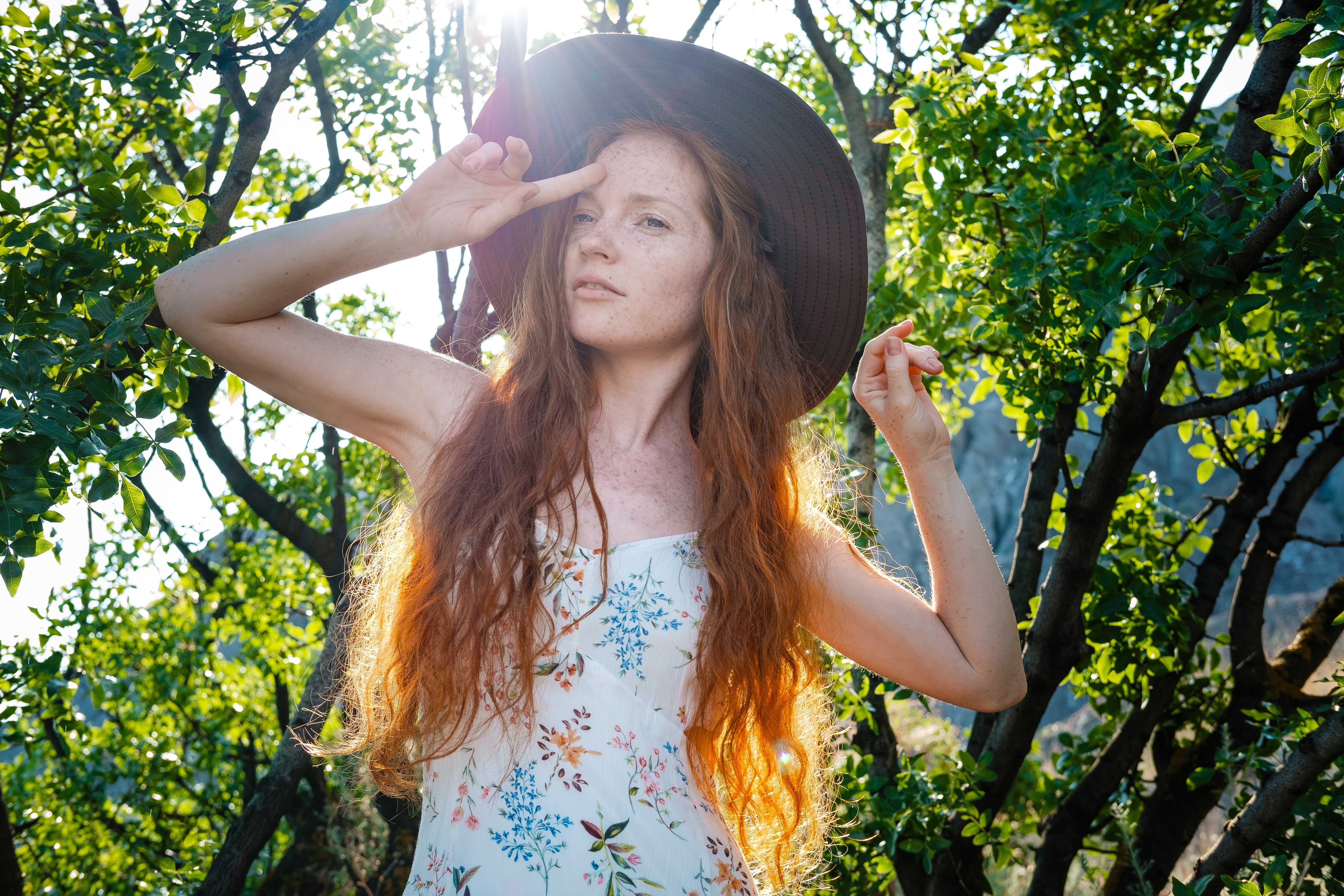 I’ve been described as going a particular shade of apricot when exposed to sunlight, much like a bashful vampire