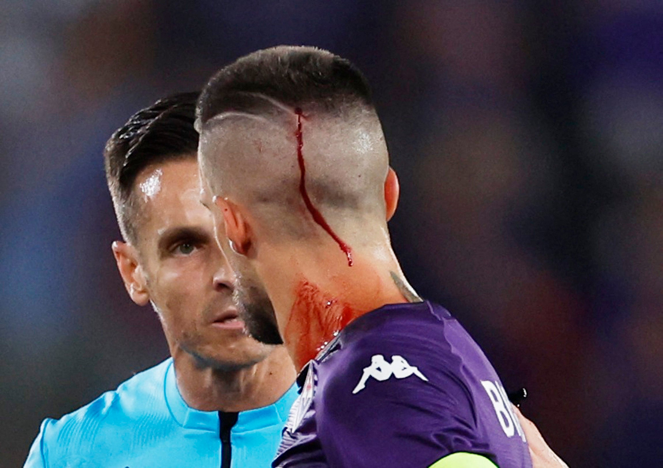 Cristiano Biraghi needed treatment for the head wound