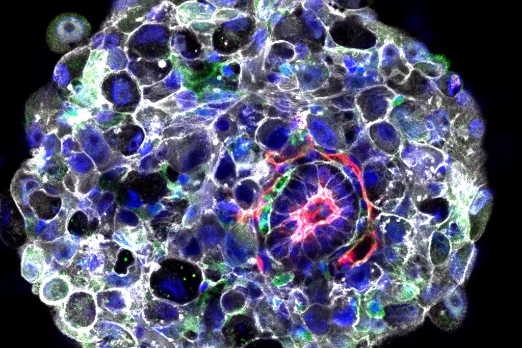 Scientists have created synthetic human embryos using stem cells – a move experts say could provide insight into causes of miscarriages and unique aspects of human development but raises ethical and legal questions (University of Cambridge/PA)