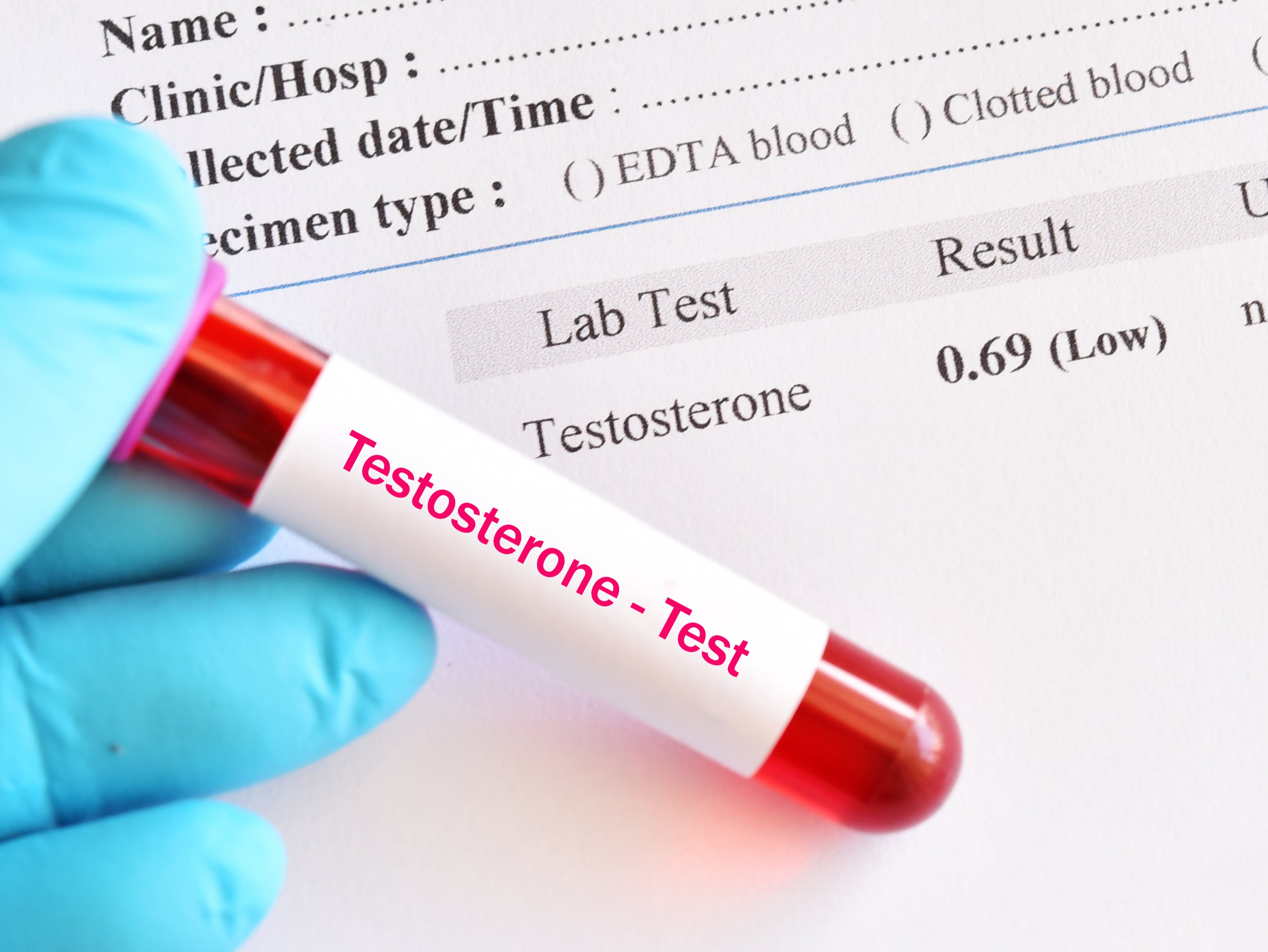 ‘I also got it done because I was interested in – apologies for the lofty language – “having a conversation” with my testosterone, the way a lot of my peers currently do’