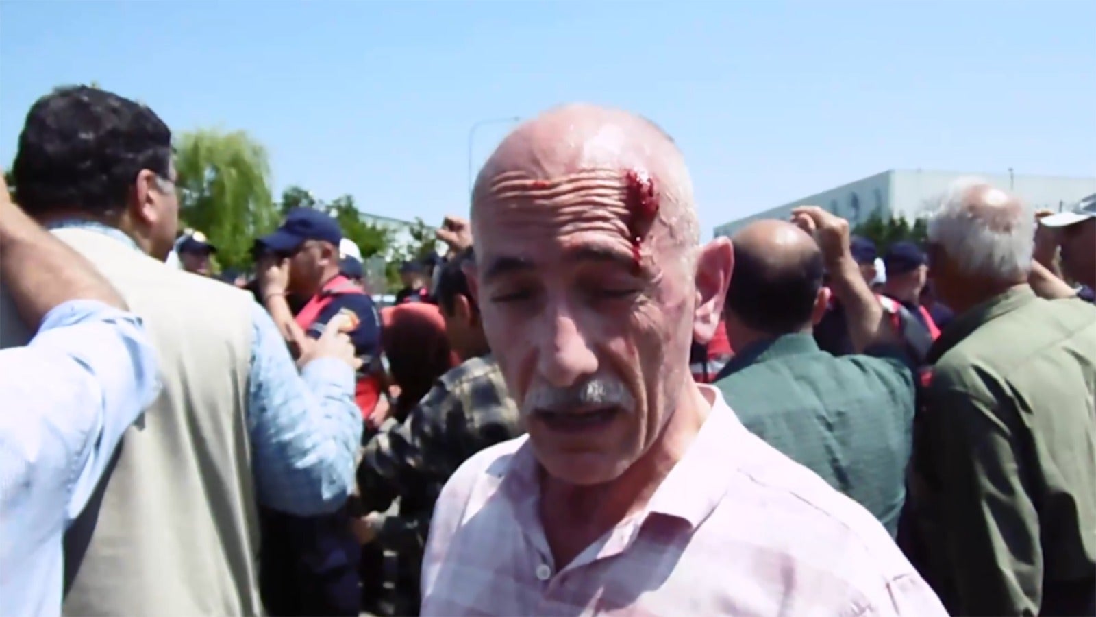 An unidentified man stands after being struck on the forehead during a police action at Ashraf III in Albania