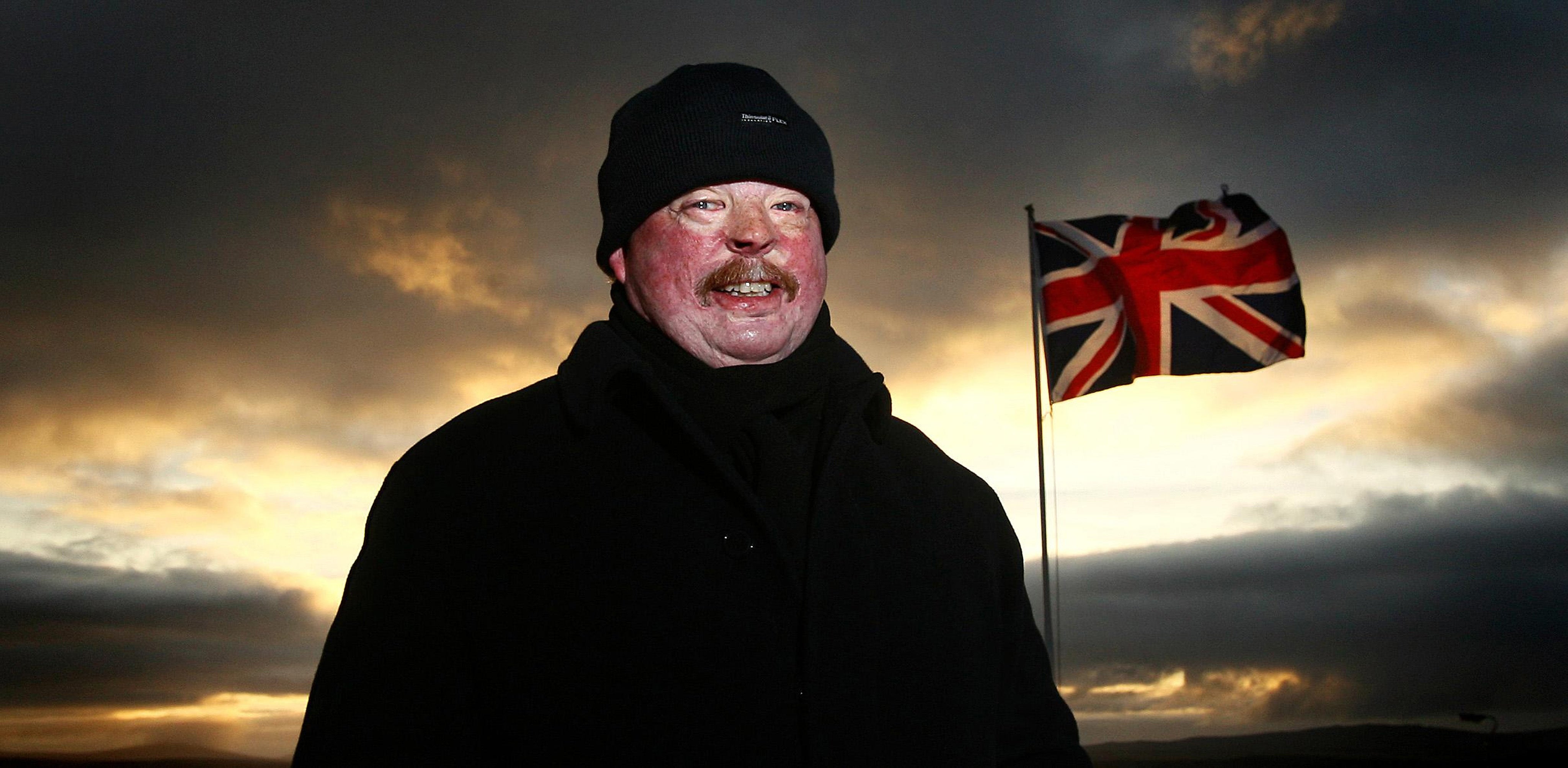 Simon Weston survived the bombing of the ship RFA Sir Galahad