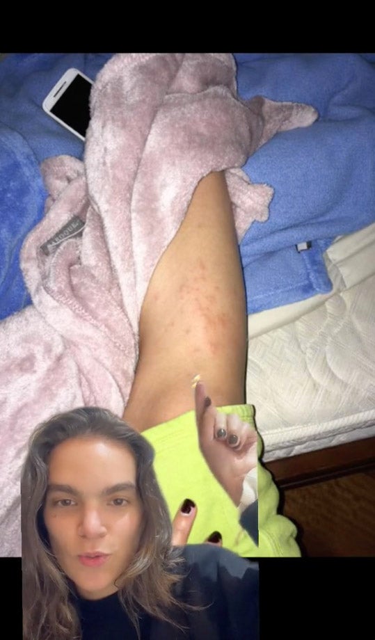 Marystella Gomez chronicled her discovery of a parasite in her leg through TikTok videos