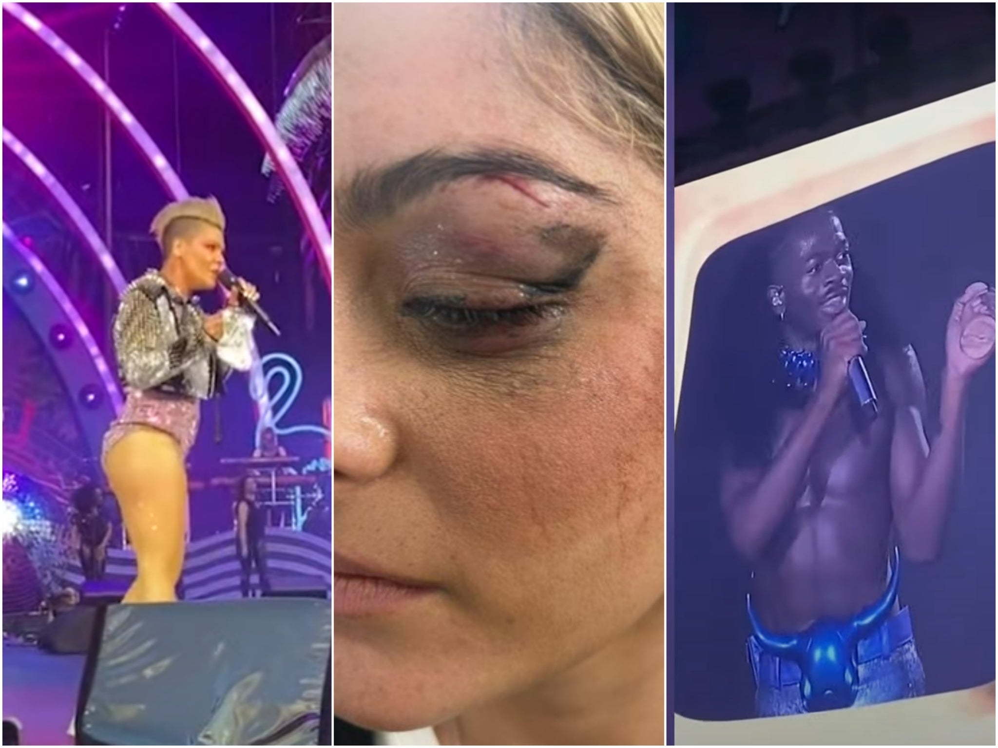 Recent incidents: Pink is handed the ashes of a fan’s dead mother on stage; Bebe Rexha shows off her eye wound; Lil Nas X is baffled by a sex toy