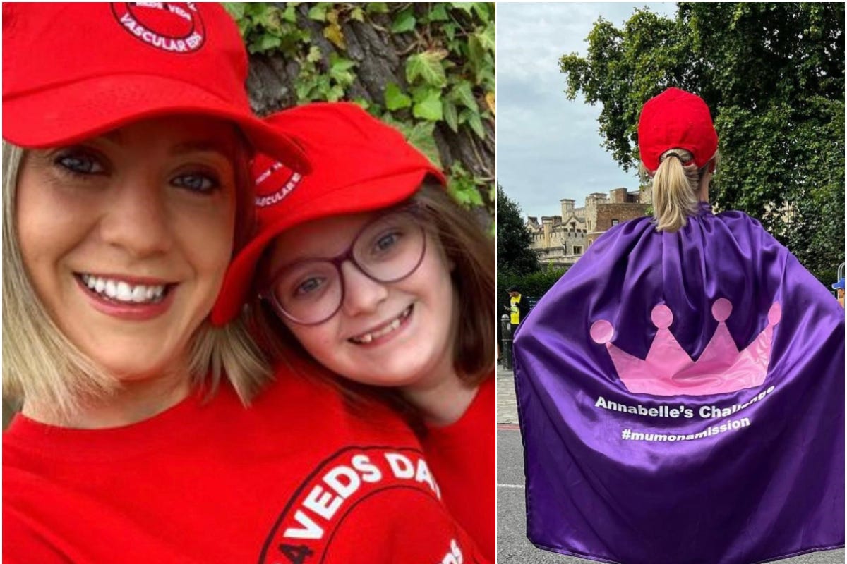 Bonnie Jackson is taking on a 10k run on Sunday to continue raising money and awareness for Veds research (Bonnie Jackson/PA)