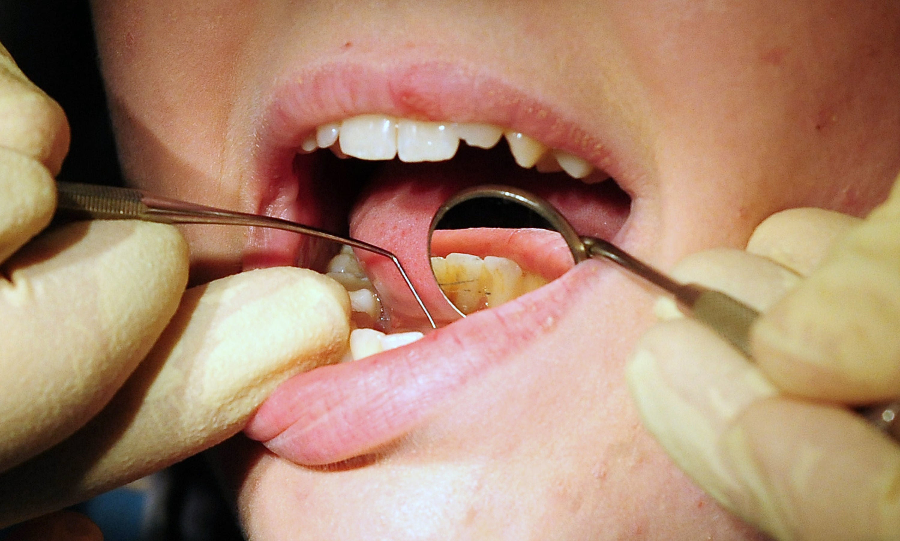 10% of people admitted to attempting “DIY dentistry”