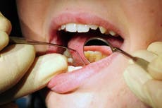 People forced to pull out their own teeth amid NHS dental crisis, report finds