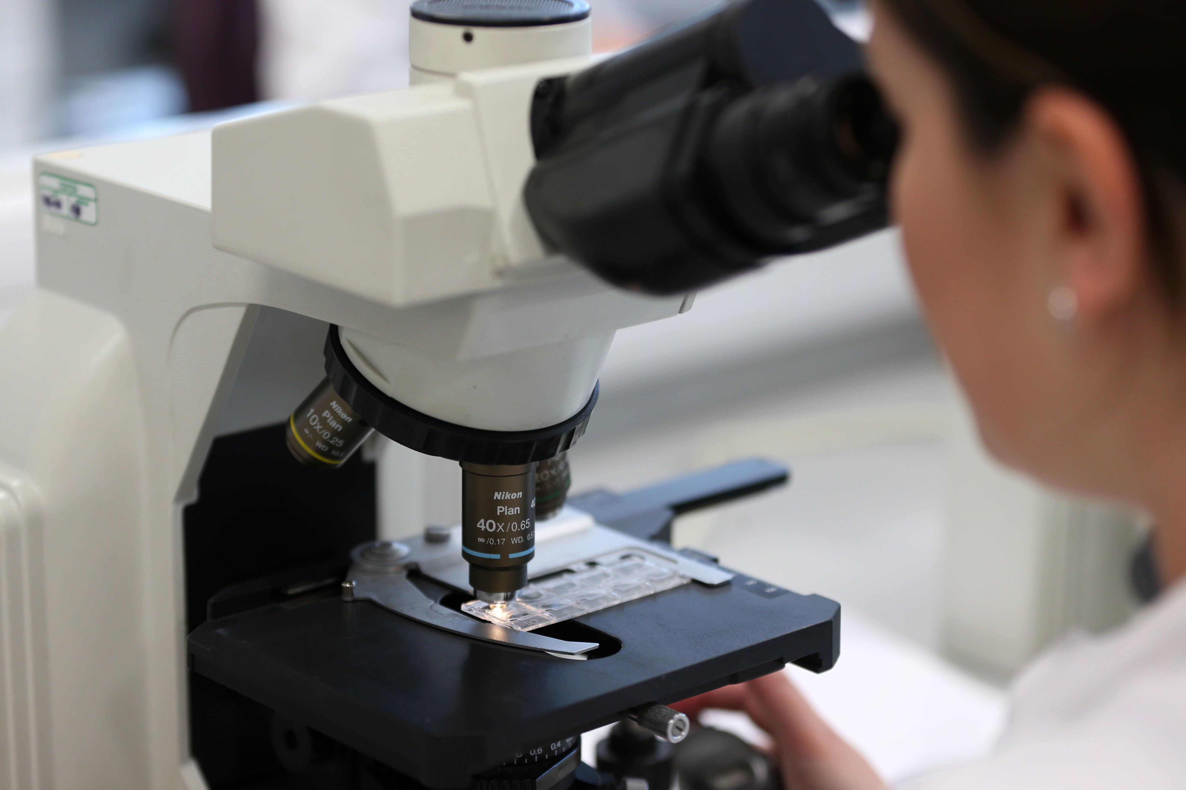 The research team will test its new therapies on a virtual patient, which will be created using samples from a patient’s tumour and immune system (Lynne Cameron/PA)