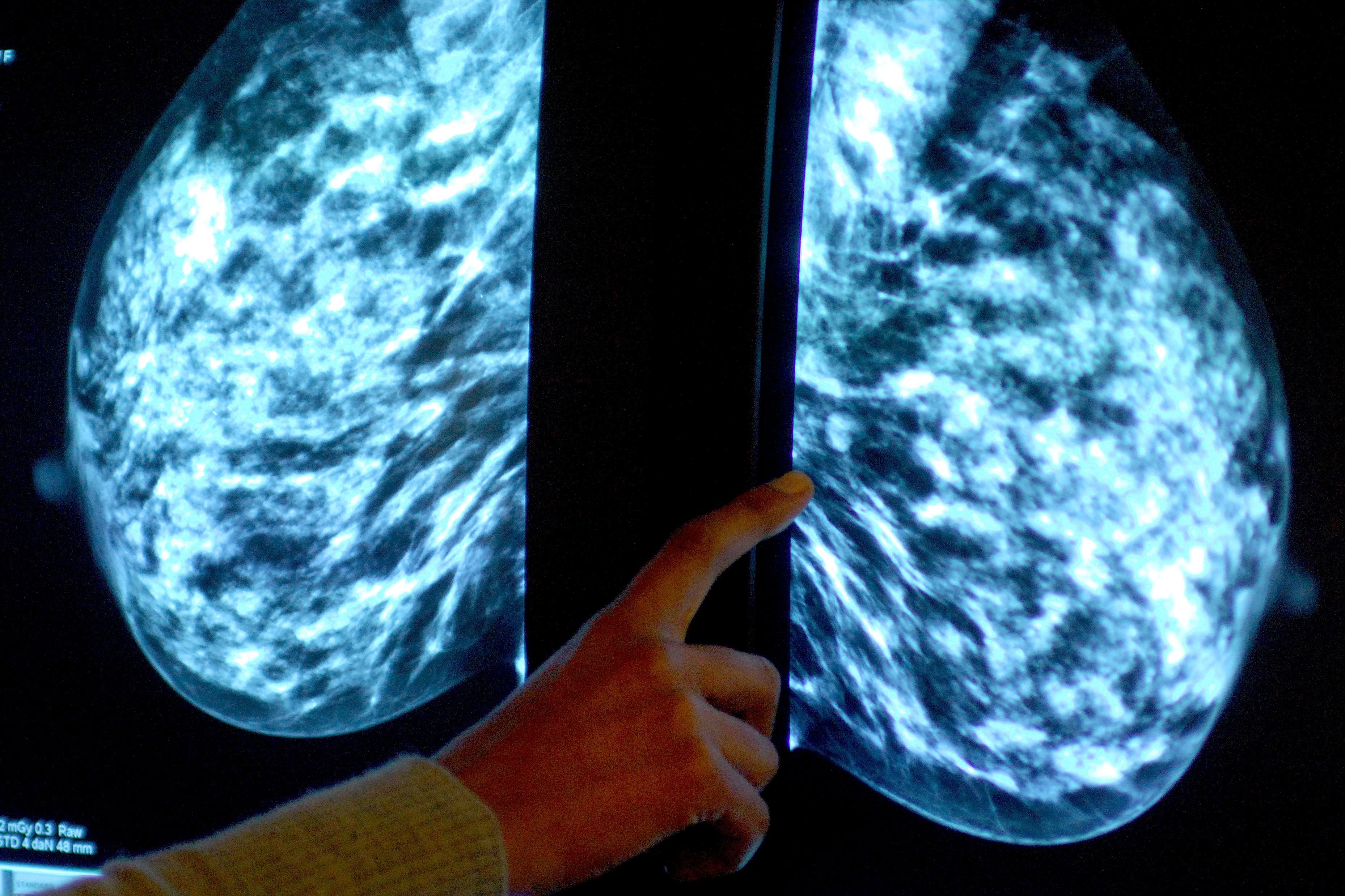 Radiologists can earn double by doing overtime (Rui Vieira/PA)