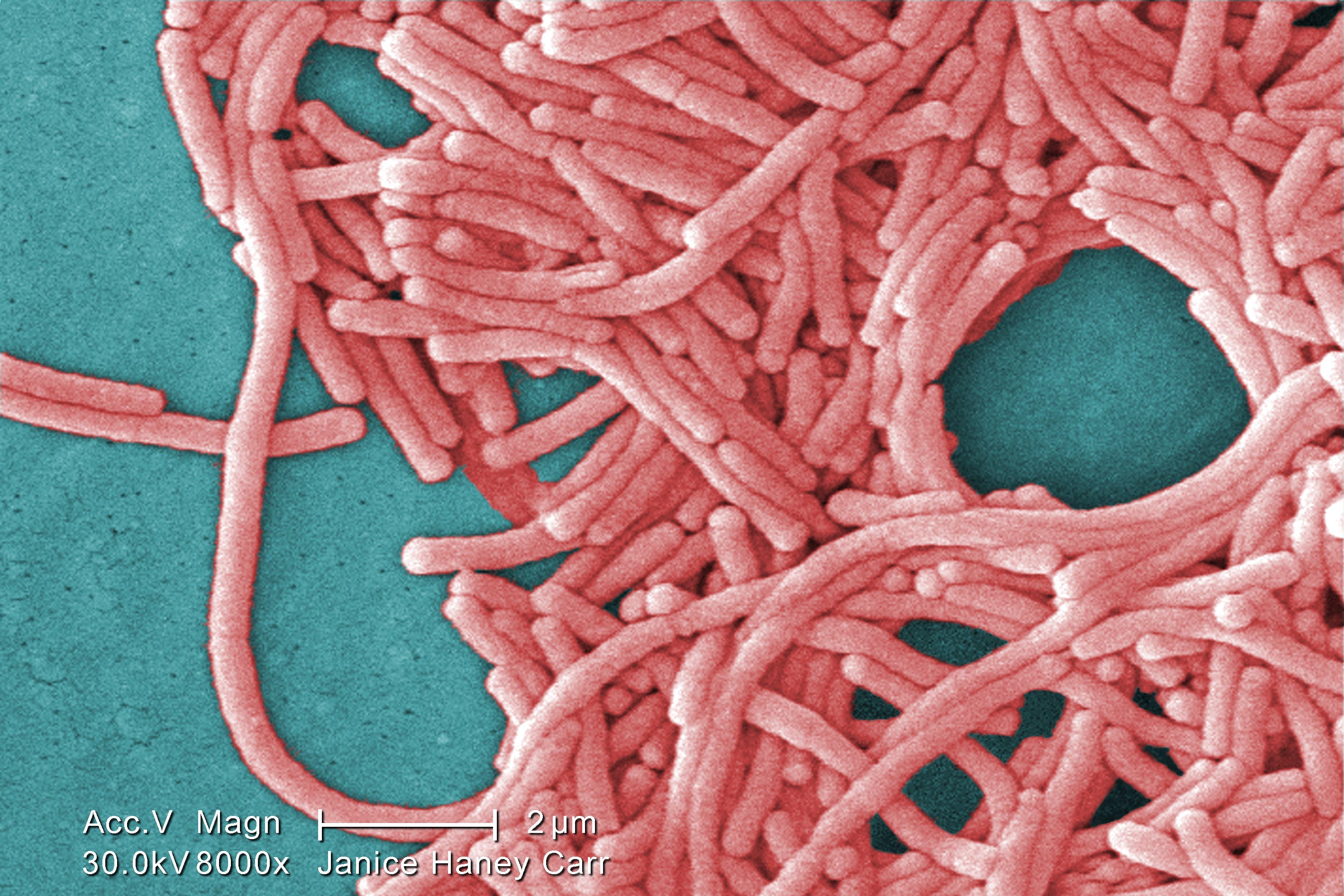 Legionella bacteria can lead to the serious lung disease, Legionnaires’ (Jance Haney Carr/Centers for Disease Control and Prevention)