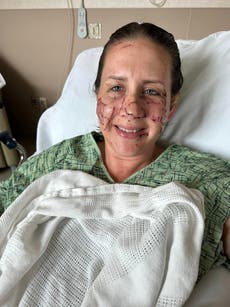 Woman brutally attacked by otter while tubing down Montana river