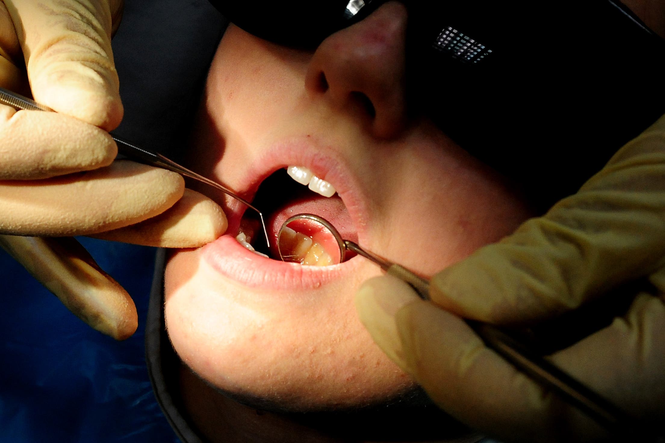 The consultation on dental hygienists forms part of the Primary Care Recovery Plan (Rui Vieira/PA)