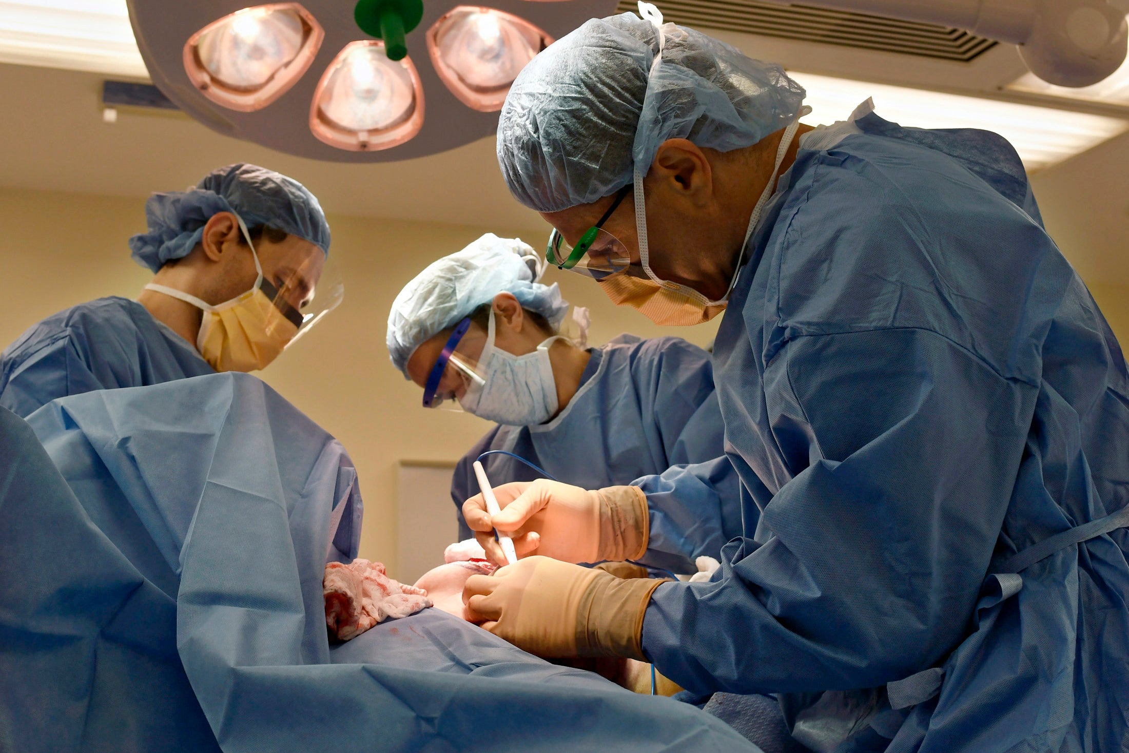 Transgender Health Surgeries