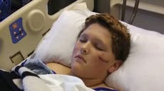 North Carolina boy, 12, attacked by pack of dogs: ‘They were eating him’