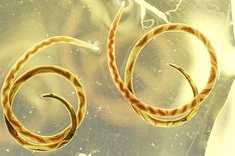 Worm that jumps from rats to human brains invades southeastern US