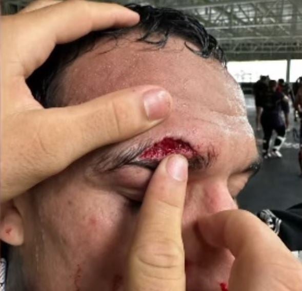 Oliveira was ruled out of UFC 294 after sustaining a nasty cut