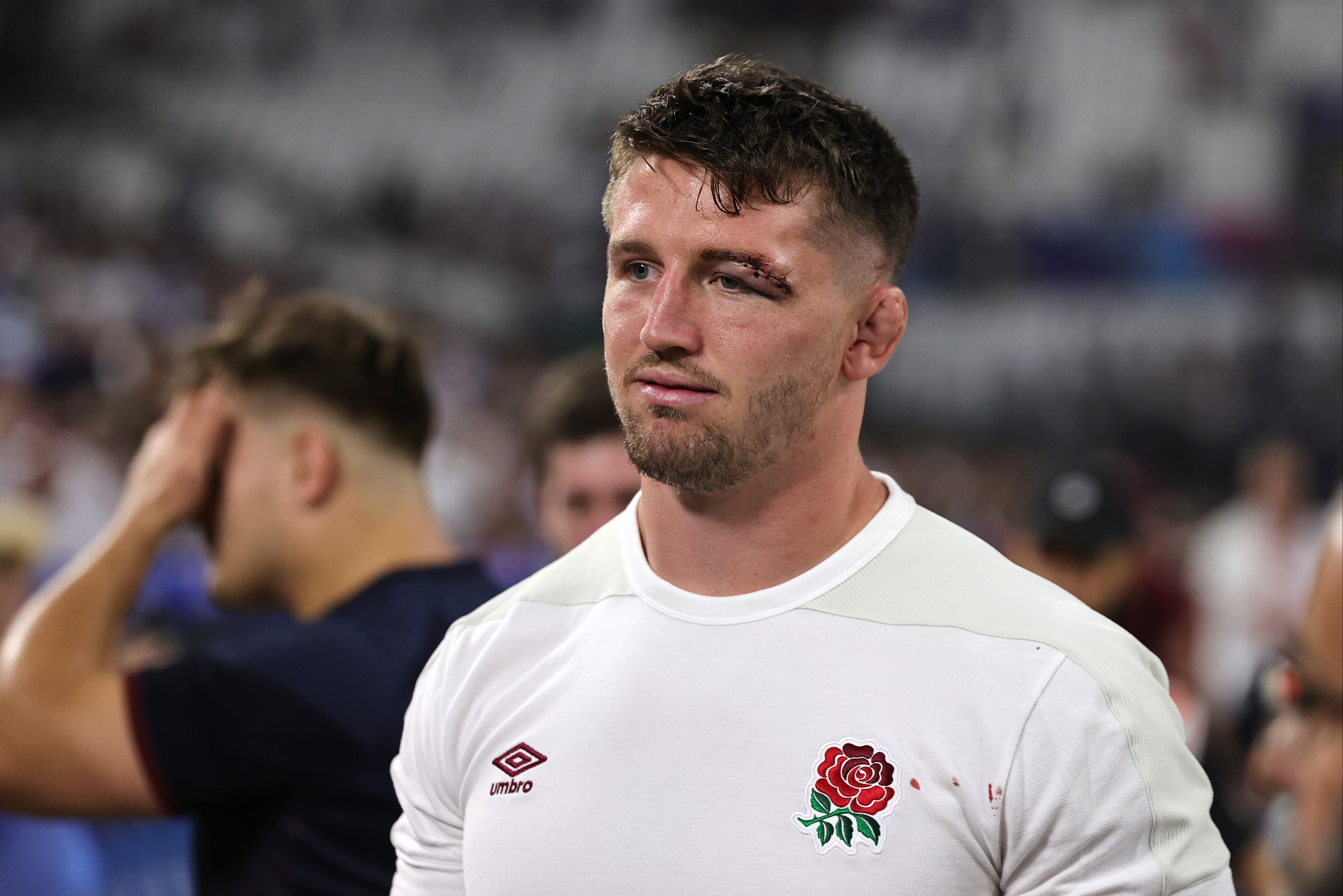 England’s Tom Curry faces a lengthy spell on the sidelines