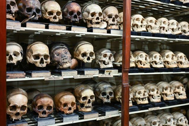<p>The University of Edinburgh’s ‘skull room’ holds one of the largest and most historically significant collections of ancestral remains </p>