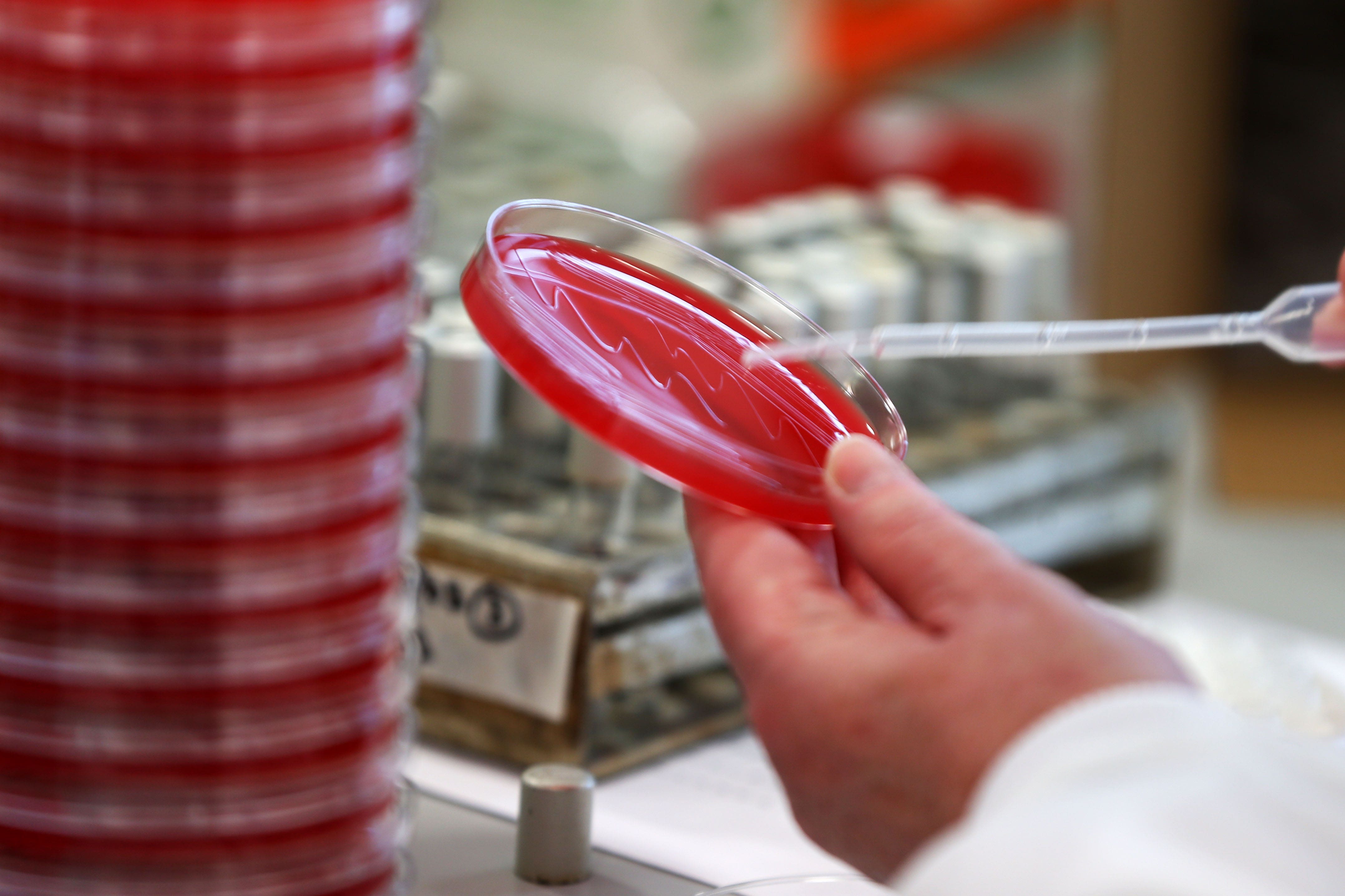 Researchers are developing a lateral flow test to detect brain tumours (Lynne Cameron/PA)