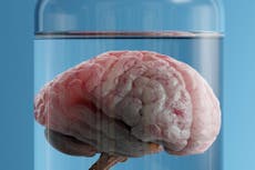 Scientists invent device to keep brain alive while severed from the body