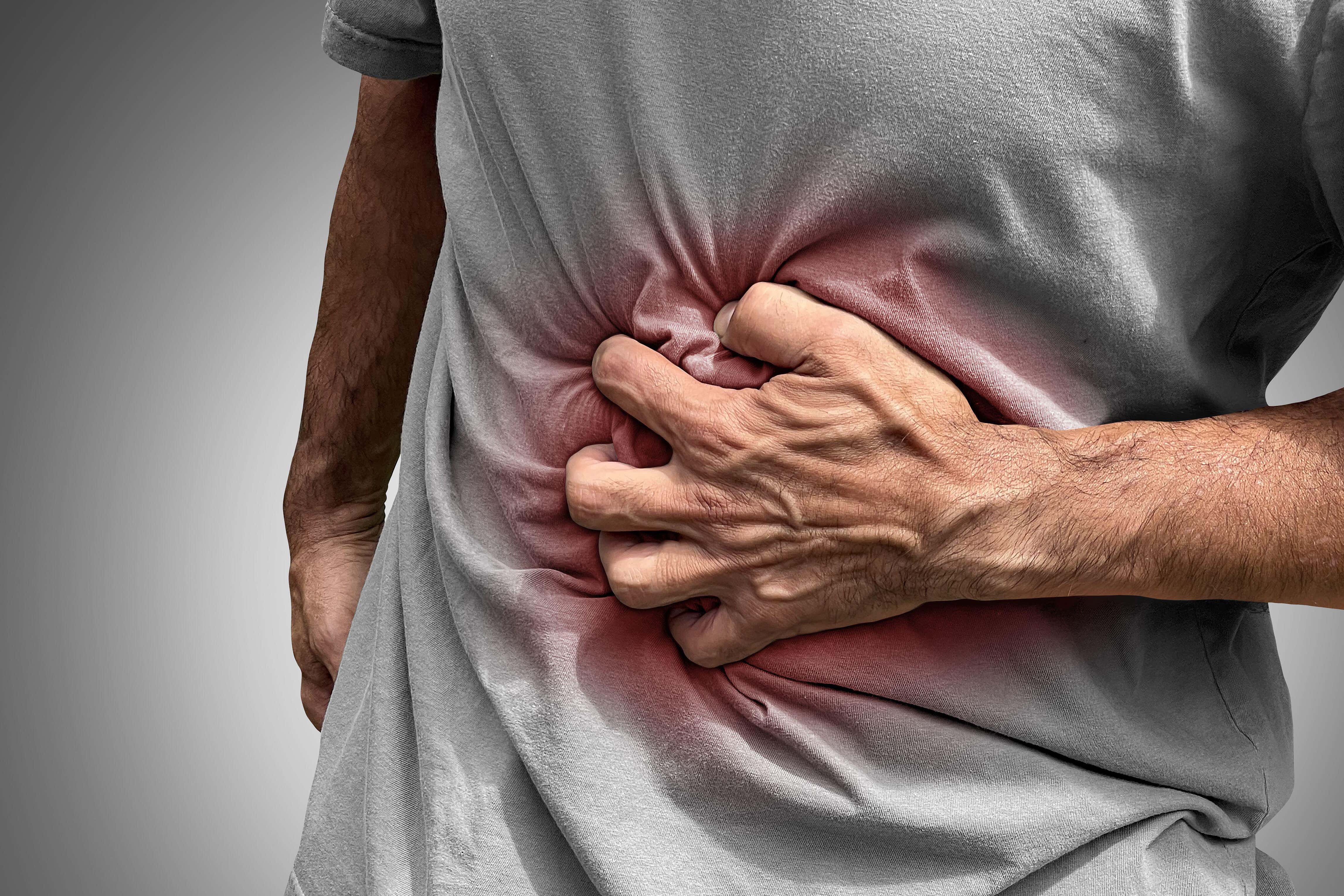 Crohn’s disease and colitis sufferers can experience severe stomach or bowel pain and have to be careful what food they eat (Alamy/PA)