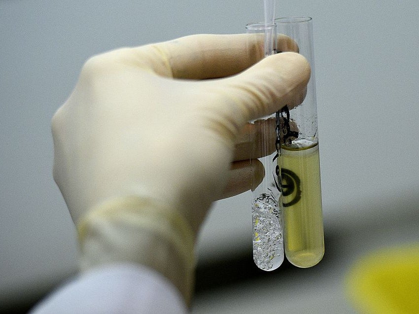 A urine sample at France’s national anti-doping lab near Paris, 2015