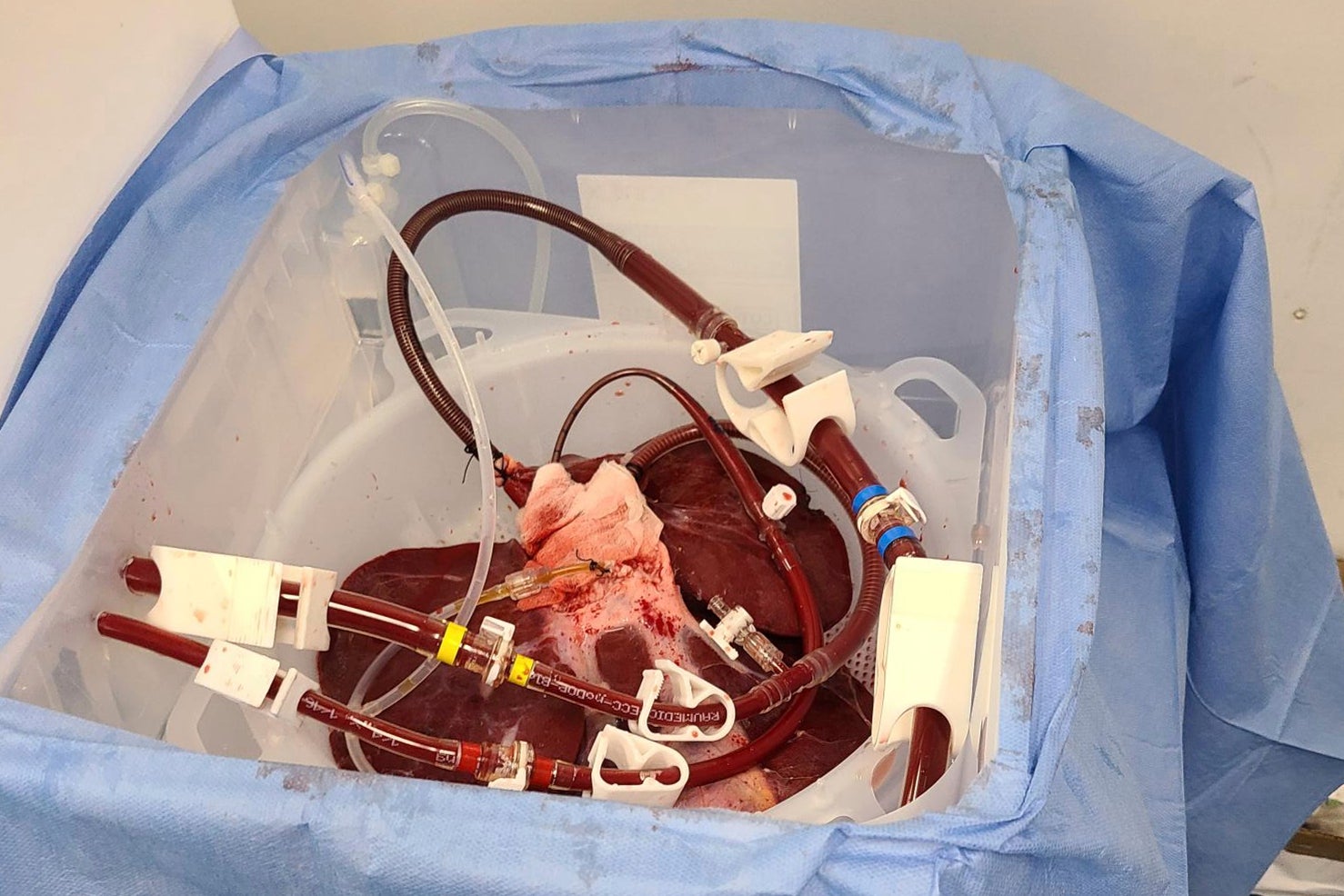 Pig Liver Experiment