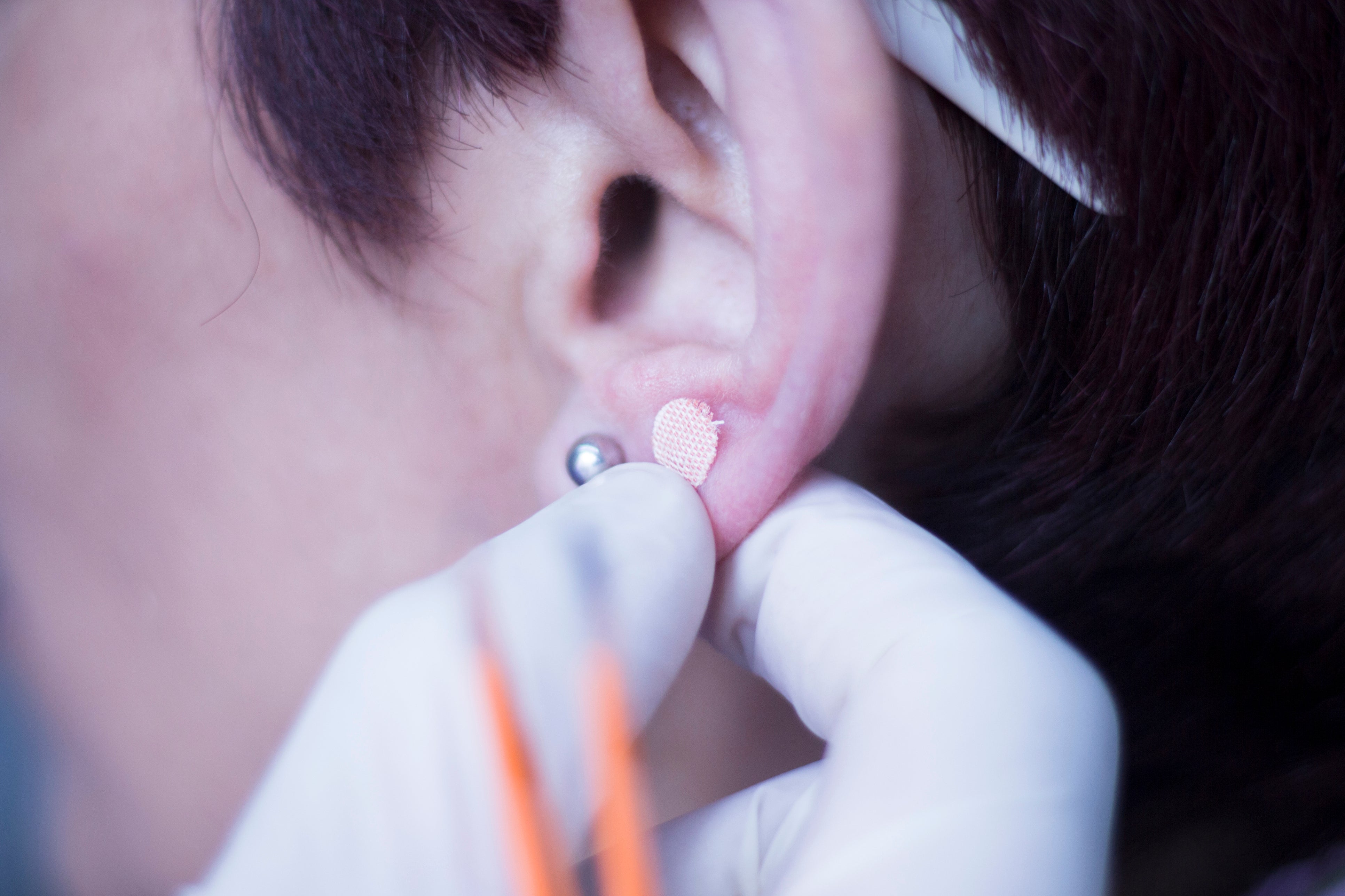 In the episode, which aired on January 18, Giselle Boxer said ear seeds were among what she used to aid her recovery from ME