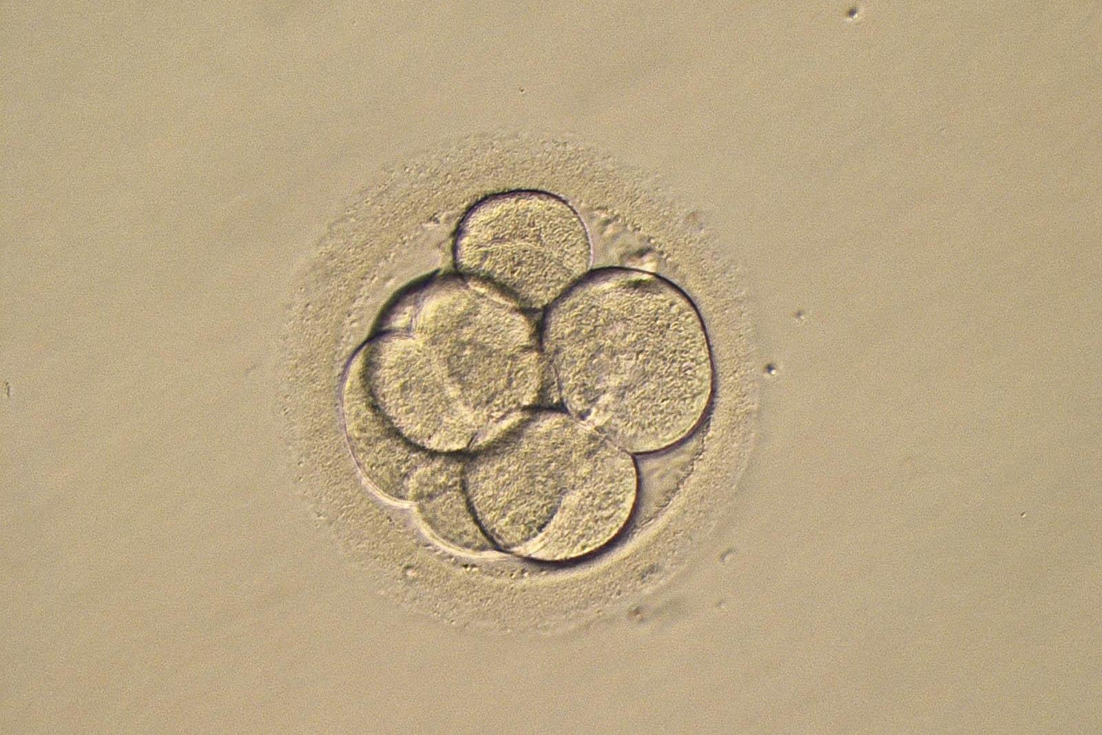 A photo of a three-day-old human embryo (PA)