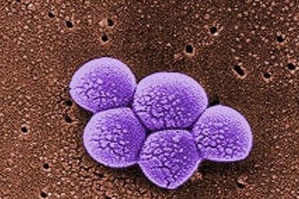 More people have been infected with methicillin-resistant Staphylococcus aureus (MRSA) bacteria in the community