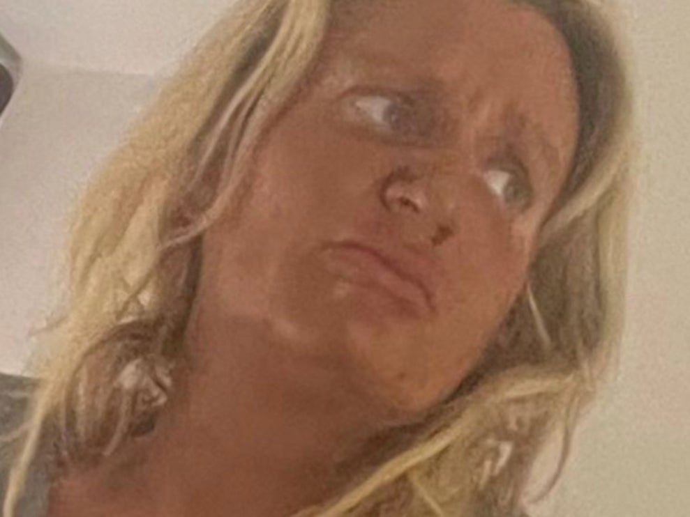 Daisy May Cooper asked her fans for help after staining her face with 20-year-old fake tan